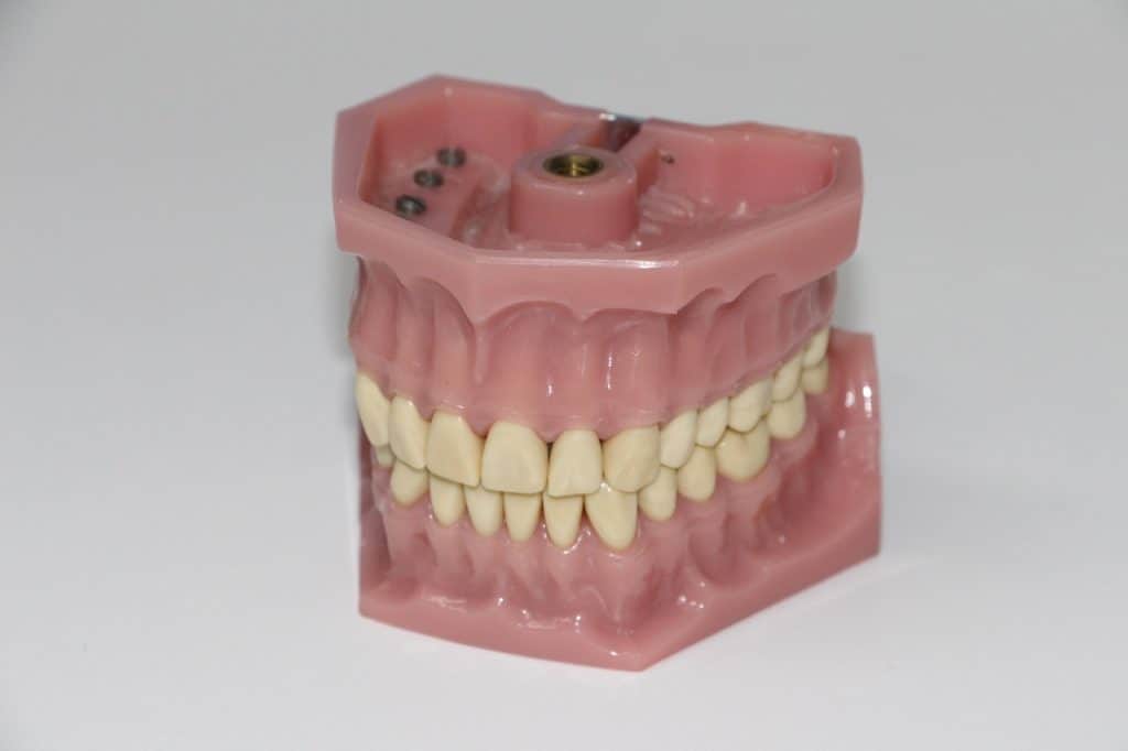 שיניים תותבות